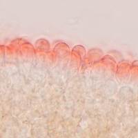 Pileipellis of <em>Agrocybe pediades</em>