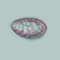 Spores of Hebeloma sinapizans