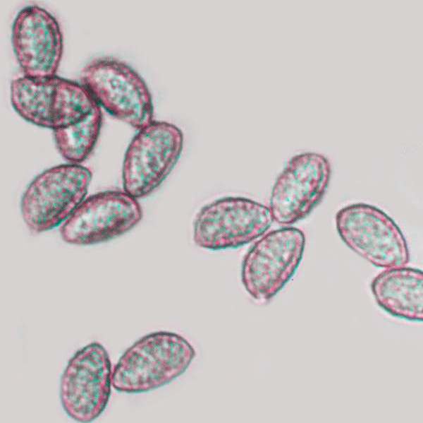 Spores of Hebeloma sinapizans