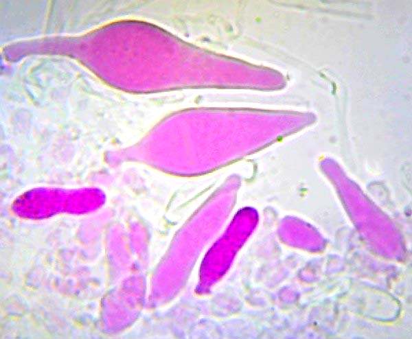 Cheilocystidia of Pholiota lubrica