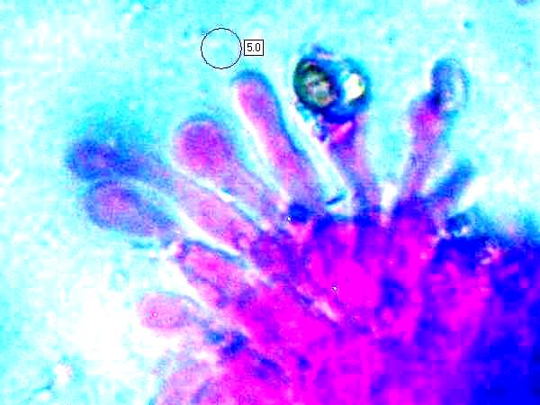 cheilocystidia of Stropharia pseudocyanea