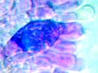 Pleurochrysocystidia of Stropharia pseudocyanea