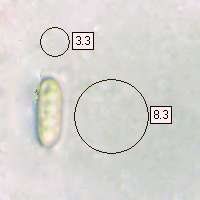 Spores of Suillus bovinus