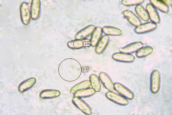 Spores of Suillus collinitus