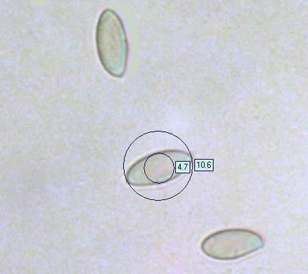 Spores of Suillus viscidus