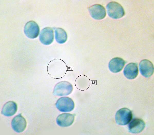 Spores of Naematelia aurantia