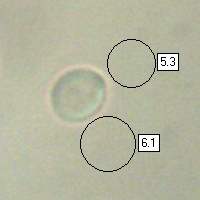 Spore of Phaeotremella foliacea