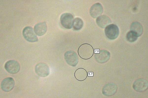 Spores of Tremella foliacea