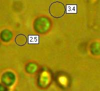 Conidia of Tremella mesenterica