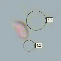 Spores of Lepista nuda, Wood Blewit