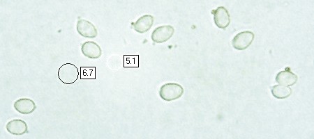 Spores of Leucocortinarius bulbiger