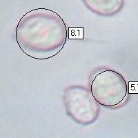 Spores of Melanoleuca cinereifolia