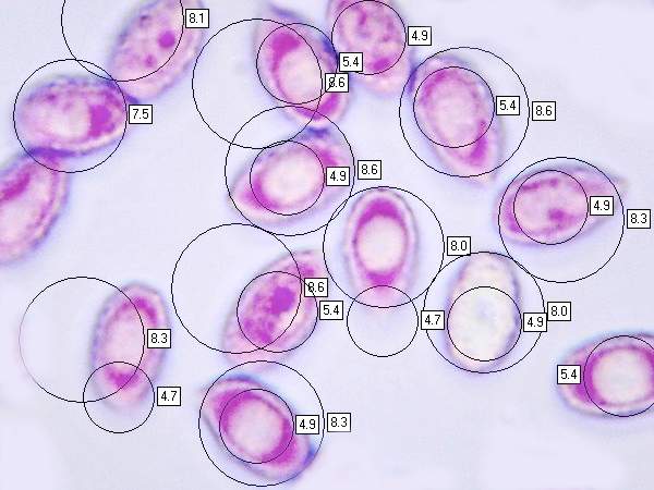 Spores of Melanoleuca grammopodia