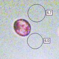 Spore of Tricholoma sciodes