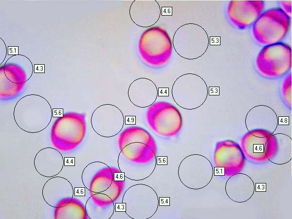 Spores of Tricholoma stans