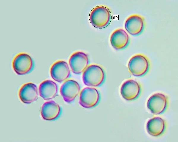 Spores of Tricholoma ustaloides
