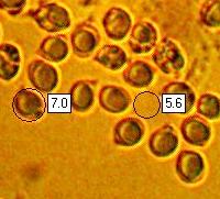 Spores of Tricholoma virgatum