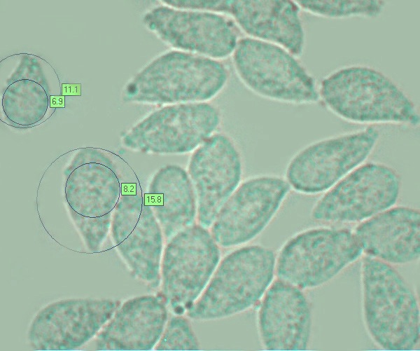 Spores of Typhula fistulosa